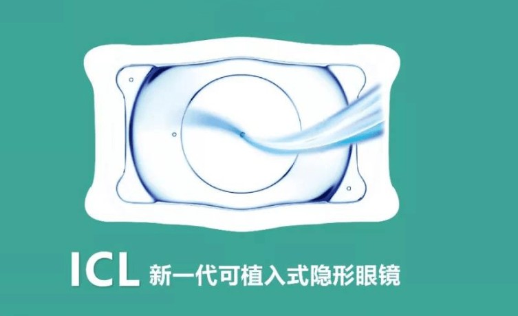 ICL晶体植入费用明细:icl比ticl晶体价格便宜3k多;比prl晶体贵4k+