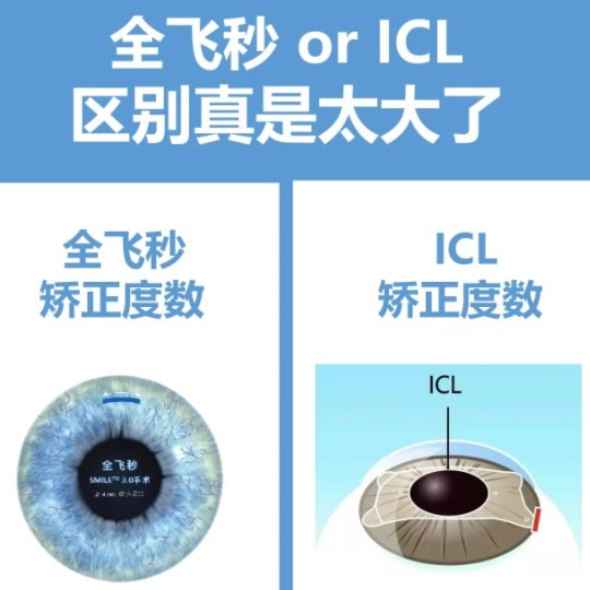 icl晶体植入和全飞秒哪个好360视界